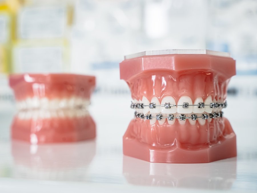 Clear dental aligners for invisible orthodontic treatment