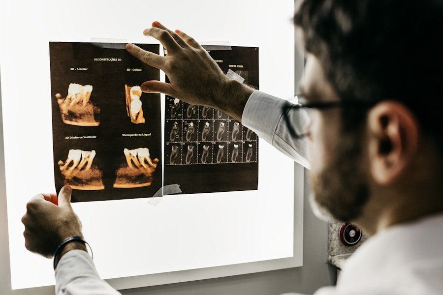 Dentist performing a gentle tooth extraction procedure