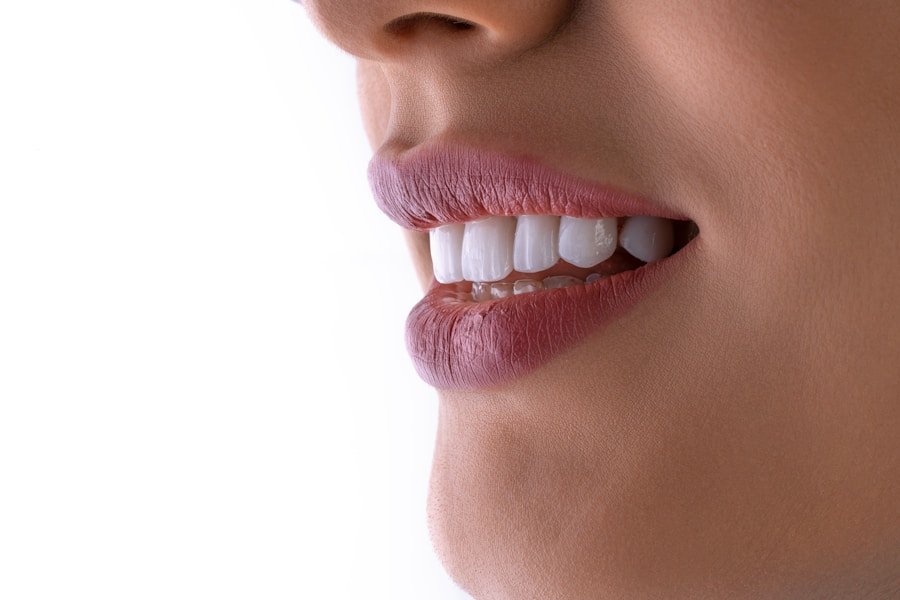 Close-up of bright white teeth after professional whitening